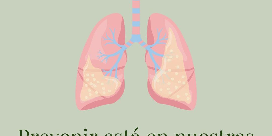 Julio Posteos Resi 2025 (3)